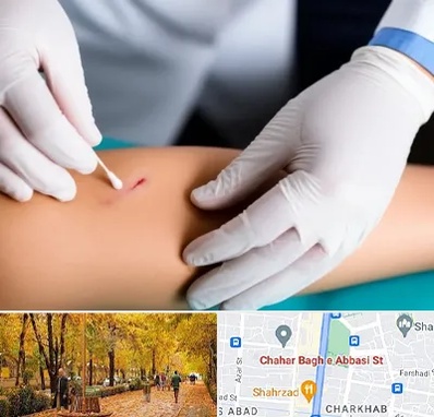 متخصص زخم عفونی در چهارباغ اصفهان 