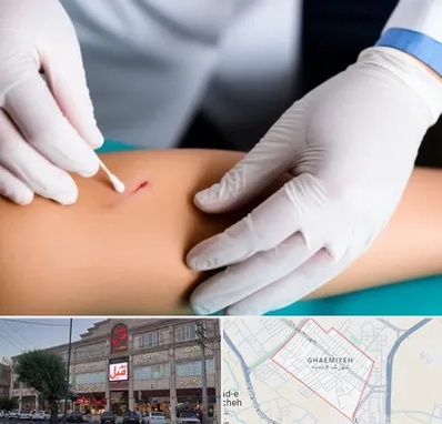 متخصص زخم عفونی در قائمیه اسلامشهر 