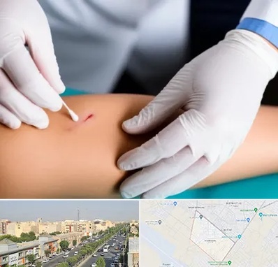 متخصص زخم عفونی در کیانمهر کرج 