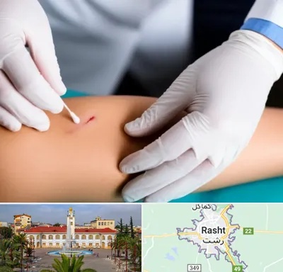 متخصص زخم عفونی در رشت