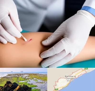 متخصص زخم عفونی در بندرلنگه