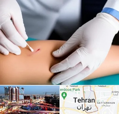 متخصص زخم عفونی در صادقیه 