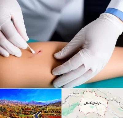 متخصص زخم عفونی در خراسان شمالی