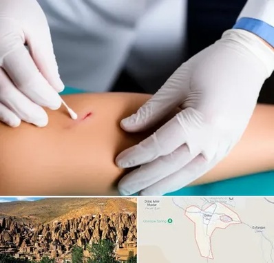 متخصص زخم عفونی در اسکو