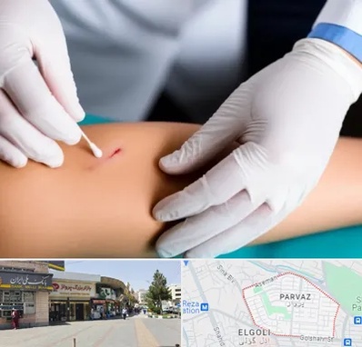 متخصص زخم عفونی در پرواز تبریز 