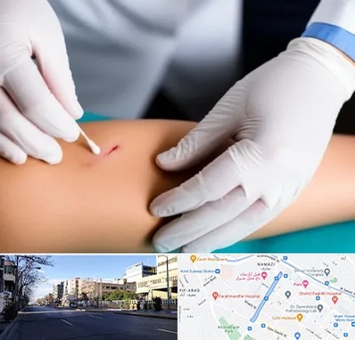 متخصص زخم عفونی در خیابان ملاصدرا شیراز 