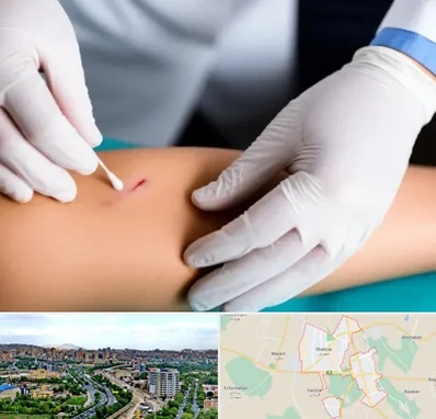 متخصص زخم عفونی در شهریار