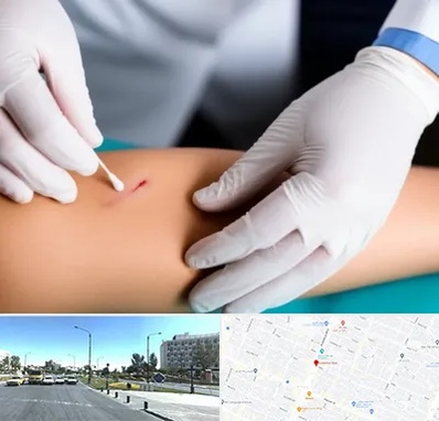 متخصص زخم عفونی در بلوار کلاهدوز مشهد 