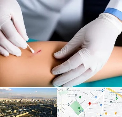 متخصص زخم عفونی در هنگام 