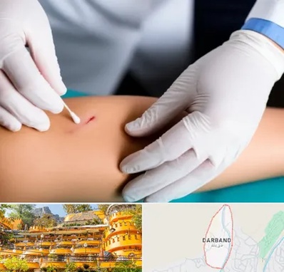 متخصص زخم عفونی در دربند 