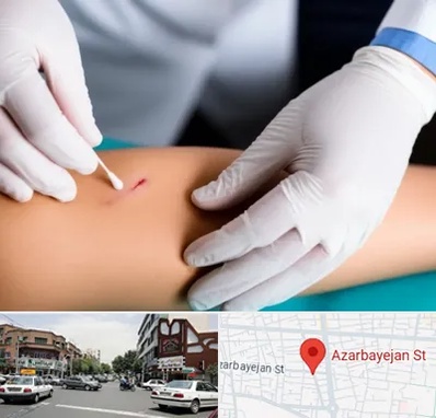 متخصص زخم عفونی در خیابان آذربایجان 