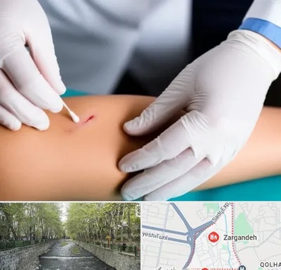 متخصص زخم عفونی در زرگنده