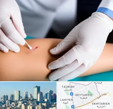 متخصص زخم عفونی در قیطریه 