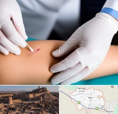 متخصص زخم عفونی در بم