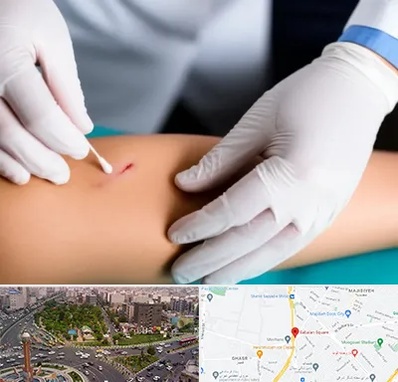 متخصص زخم عفونی در سبلان 