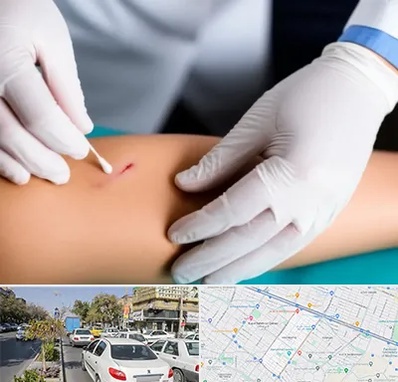 متخصص زخم عفونی در مفتح مشهد 