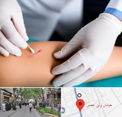 متخصص زخم عفونی در ولیعصر شهریار