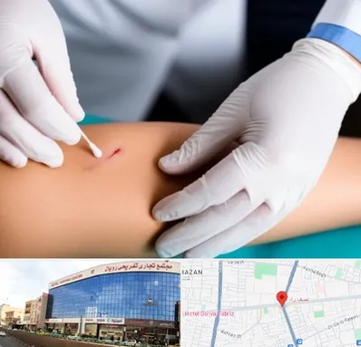 متخصص زخم عفونی در نصف راه تبریز 