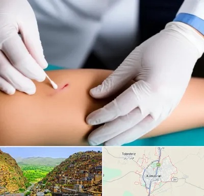 متخصص زخم عفونی در کامیاران