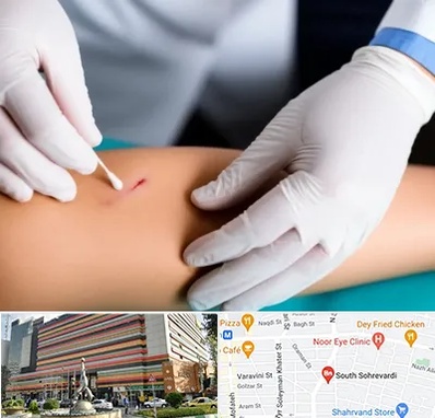 متخصص زخم عفونی در سهروردی 