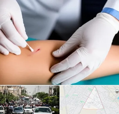 متخصص زخم عفونی در سیدی مشهد 