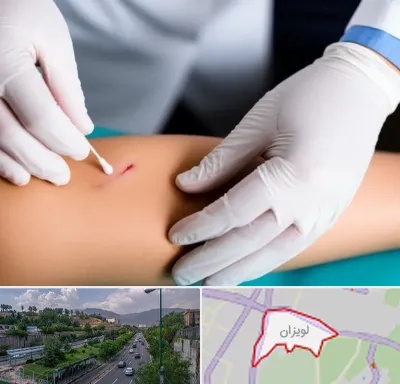 متخصص زخم عفونی در لویزان