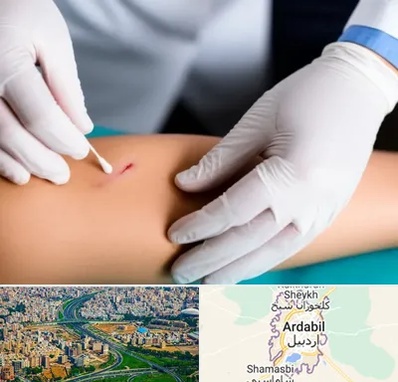 متخصص زخم عفونی در اردبیل
