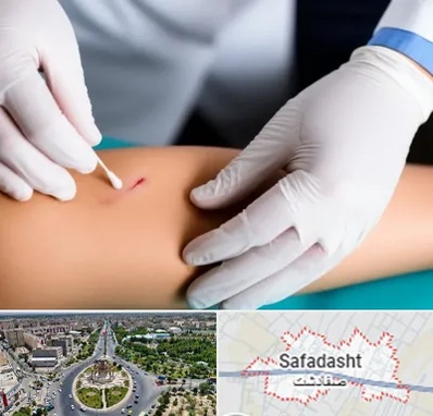 متخصص زخم عفونی در صفادشت