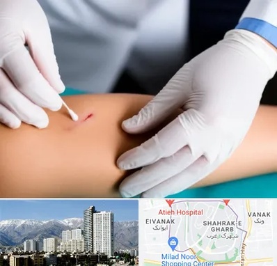 متخصص زخم عفونی در شهرک غرب 