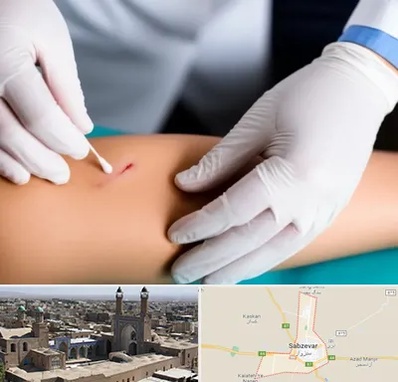 متخصص زخم عفونی در سبزوار