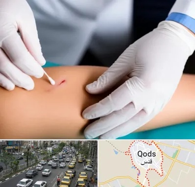 متخصص زخم عفونی در شهر قدس