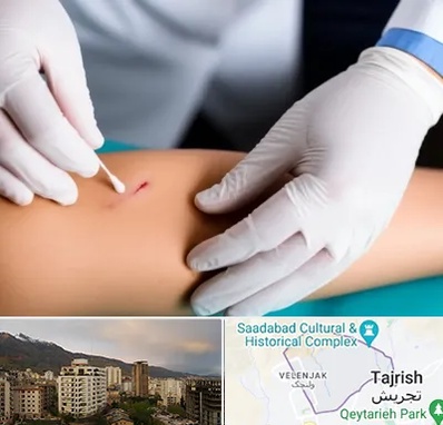 متخصص زخم عفونی در زعفرانیه 