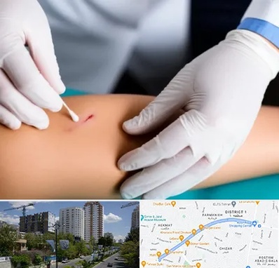 متخصص زخم عفونی در اندرزگو 