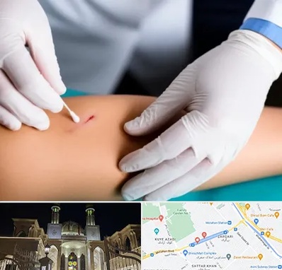 متخصص زخم عفونی در زرگری شیراز 