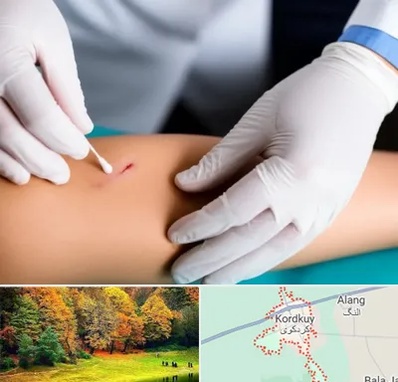 متخصص زخم عفونی در کردکوی