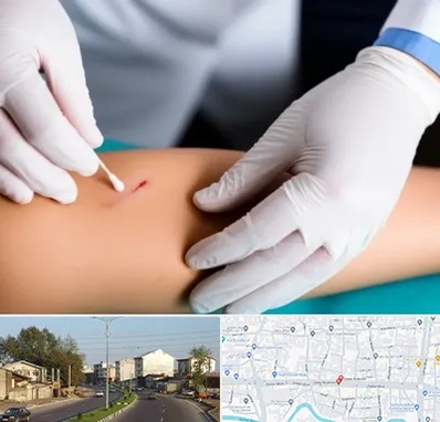 متخصص زخم عفونی در ضیابری رشت 