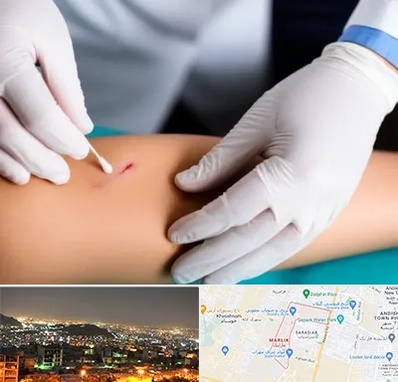 متخصص زخم عفونی در مارلیک کرج 