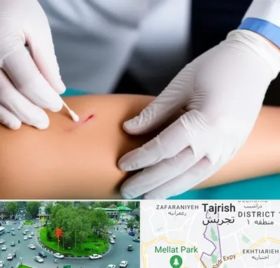 متخصص زخم عفونی در تجریش 