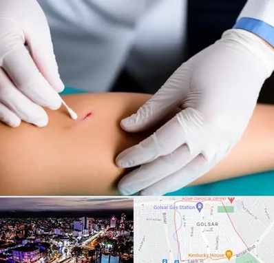 متخصص زخم عفونی در گلسار رشت 