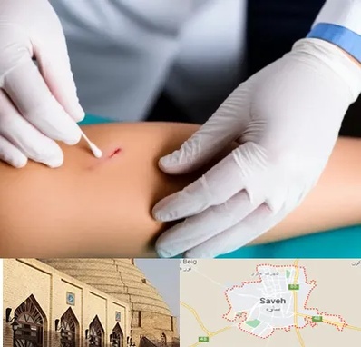 متخصص زخم عفونی در ساوه