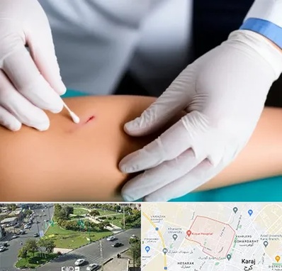 متخصص زخم عفونی در شاهین ویلا کرج 