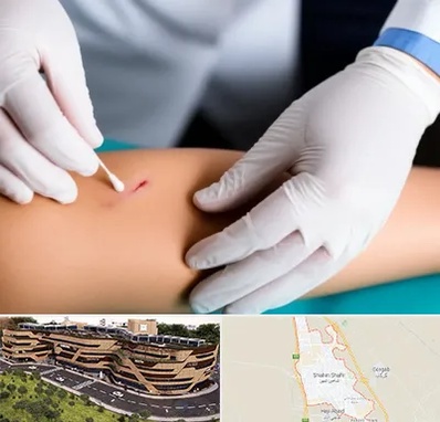 متخصص زخم عفونی در شاهین شهر