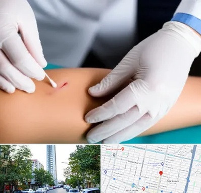 متخصص زخم عفونی در امامت مشهد 