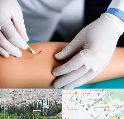 متخصص زخم عفونی در محلاتی شیراز 