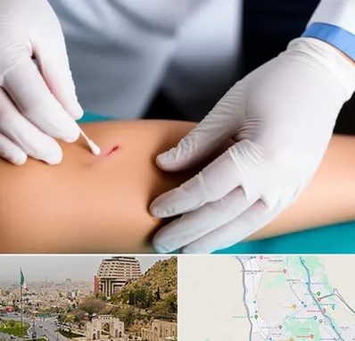 متخصص زخم عفونی در فرهنگ شهر شیراز 