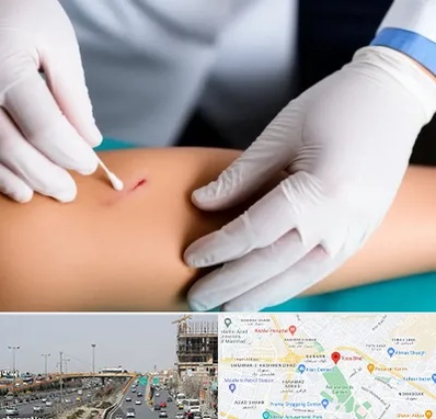 متخصص زخم عفونی در بلوار توس مشهد 