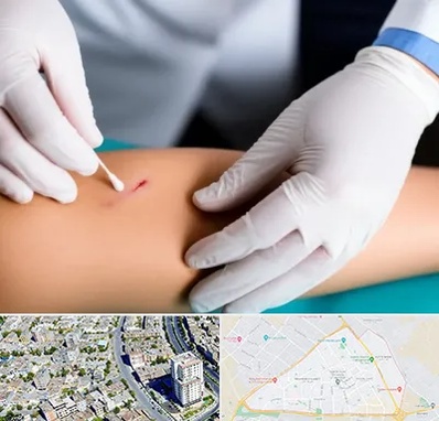 متخصص زخم عفونی در قاسم آباد مشهد 