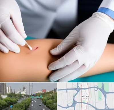 متخصص زخم عفونی در توانیر 