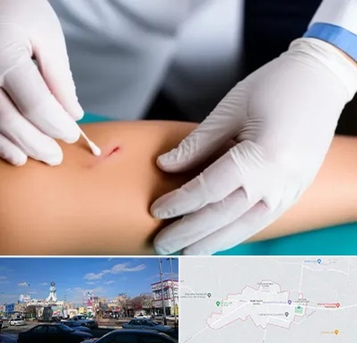 متخصص زخم عفونی در ماهدشت کرج 