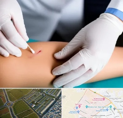 متخصص زخم عفونی در الهیه مشهد 